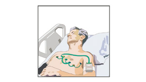 跟蹤生物標記物監測用傳感器系統開發上的進展